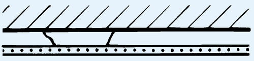 Akustik-Gipsplatte - R 1.2101 - Saint Gobain Rigips
